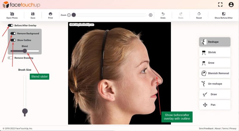 nose job simulator tool