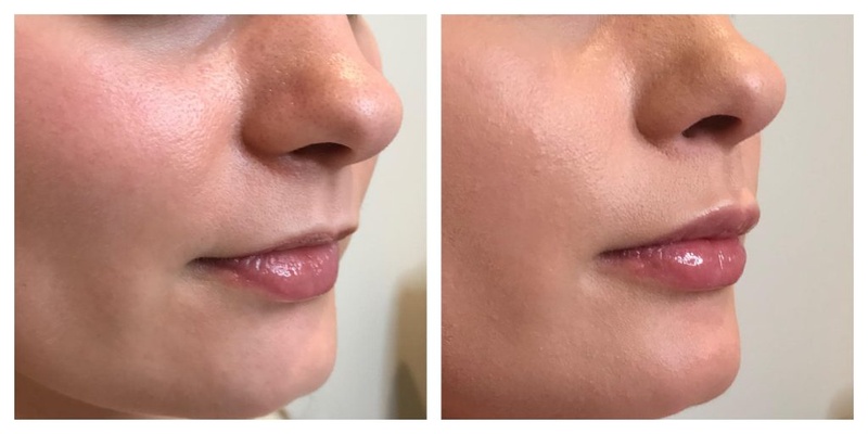 Ai Enhanced Lip Retouching Preserves Natural Skin