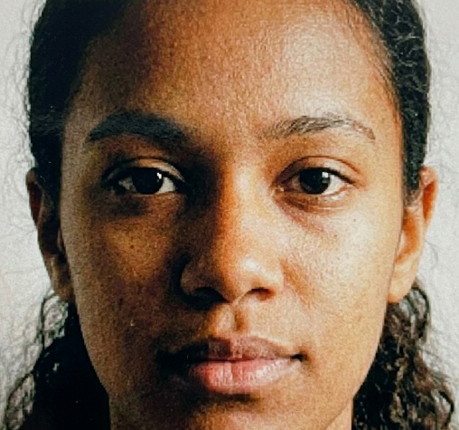 Bassa risoluzione o granulosità