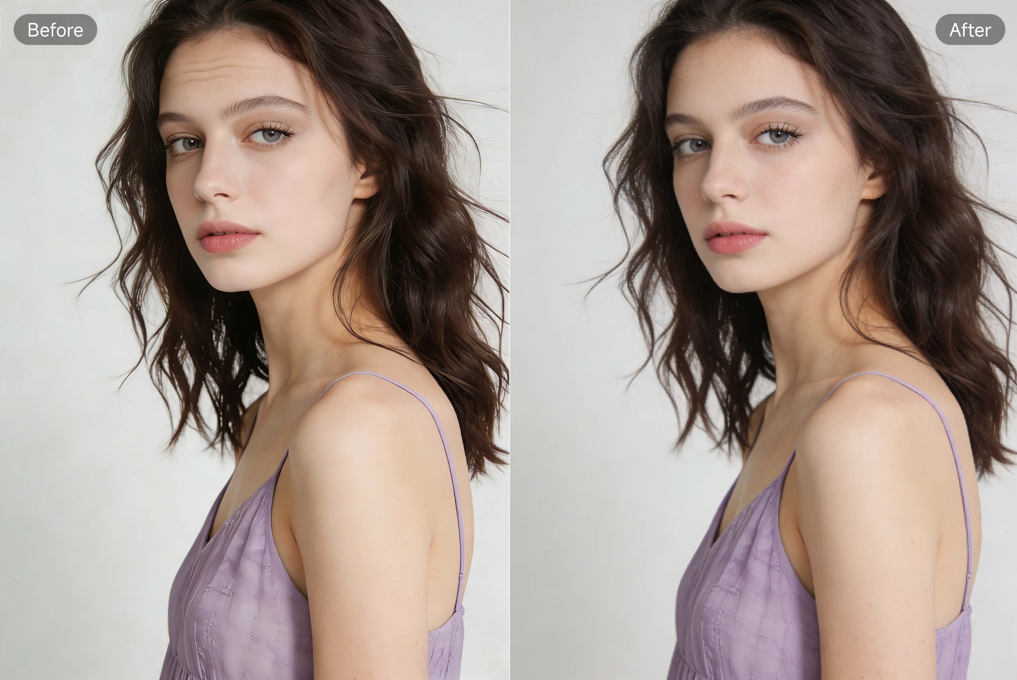 PixPretty Remove Forehead Wrinkles