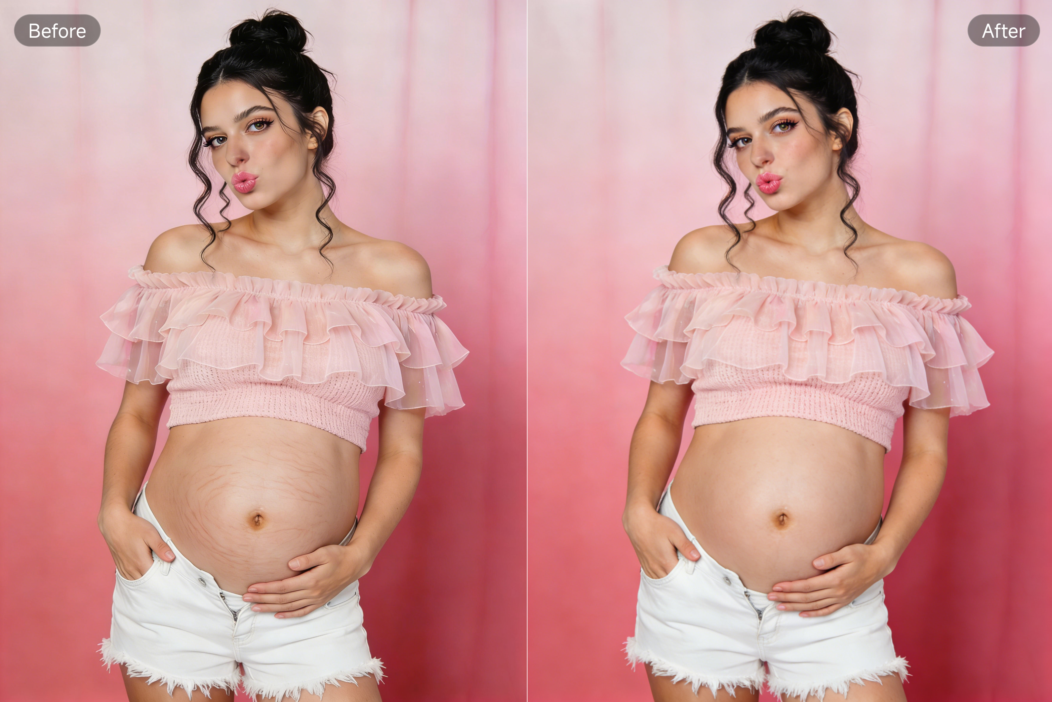 PixPretty Remove Stretch Mark