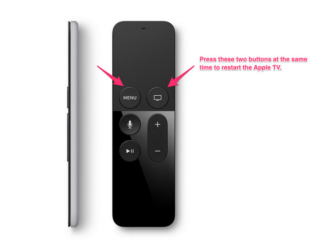Easy Ways to Fix Apple TV Black Screen